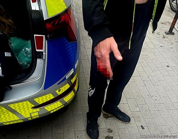 stojący koło radiowozu mężczyzna z zakrwawioną dłonią